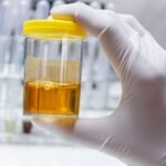 HoLEP Sonrası İdrar Akışı: Düzelme Süresi, İyileşme Süreci ve Dikkat Edilmesi Gerekenler