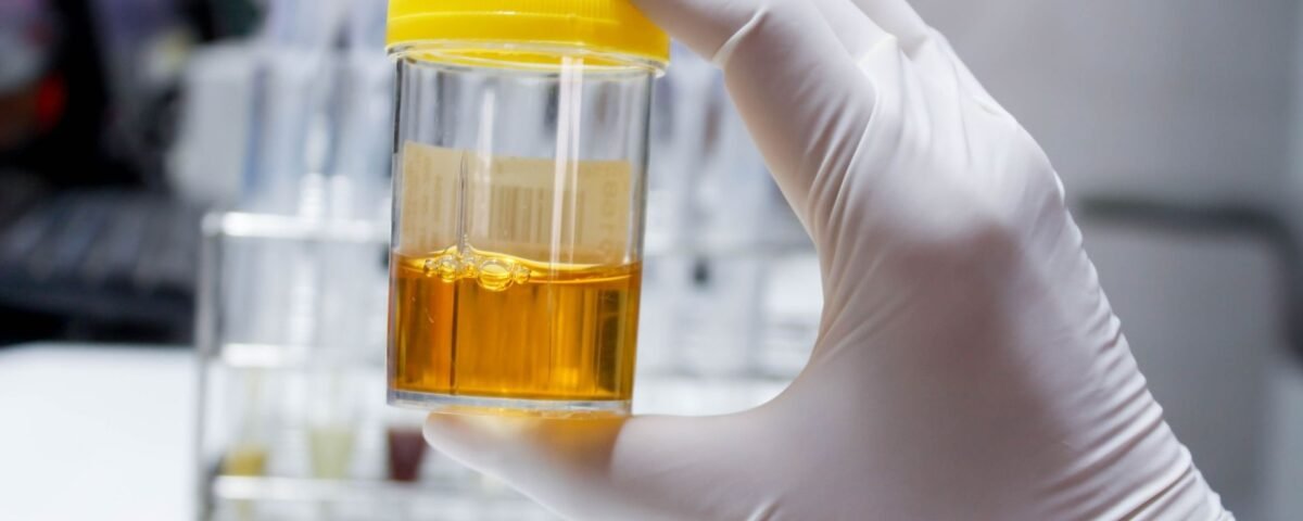 HoLEP Sonrası İdrar Akışı: Düzelme Süresi, İyileşme Süreci ve Dikkat Edilmesi Gerekenler